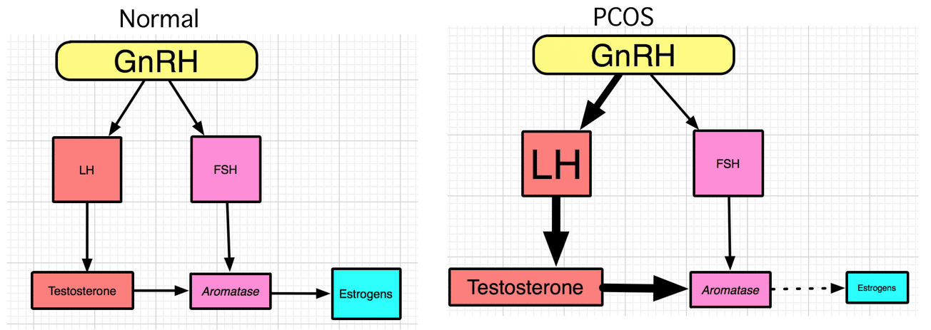 Pcos это